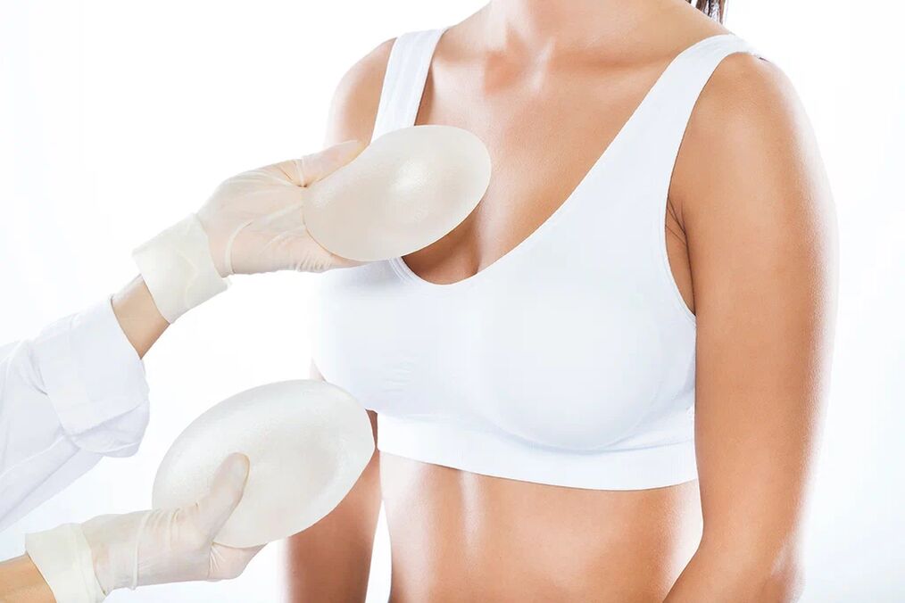 Sélection des implants avant la chirurgie d'augmentation mammaire